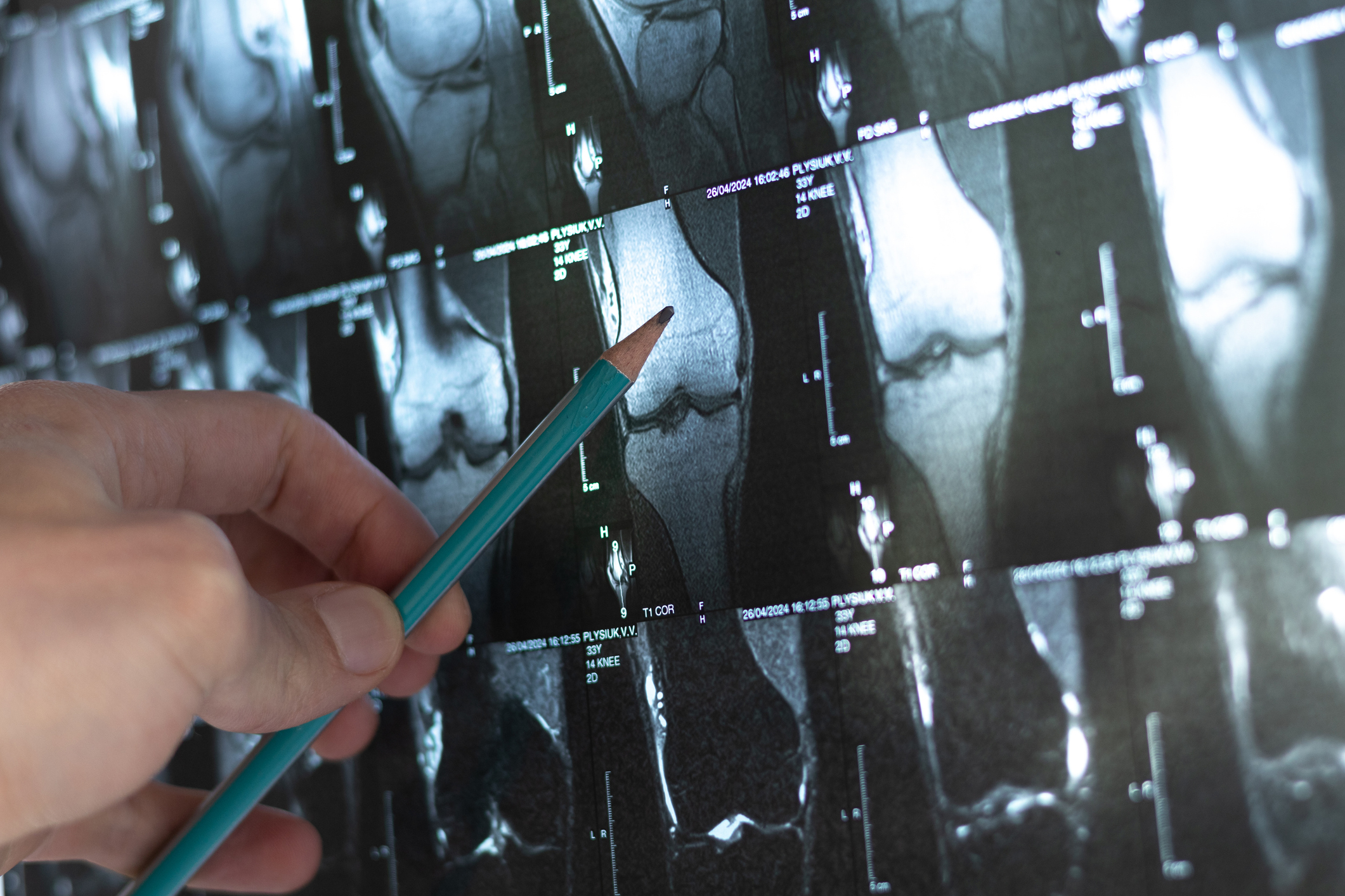 AI e radiologia AI e radiologia